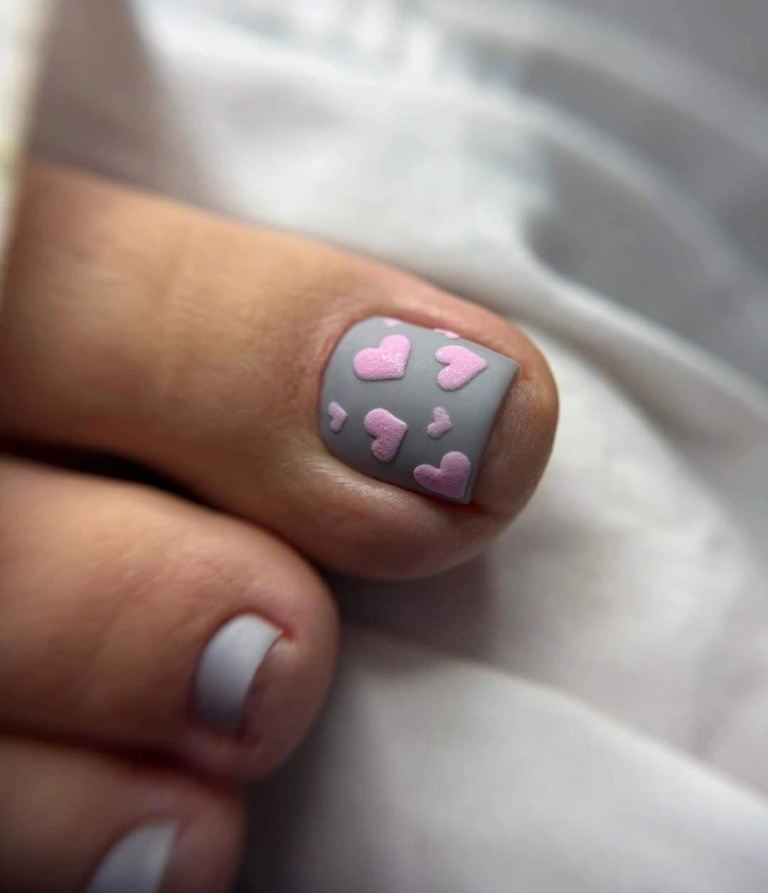 gray toenail with raised pink heart accents